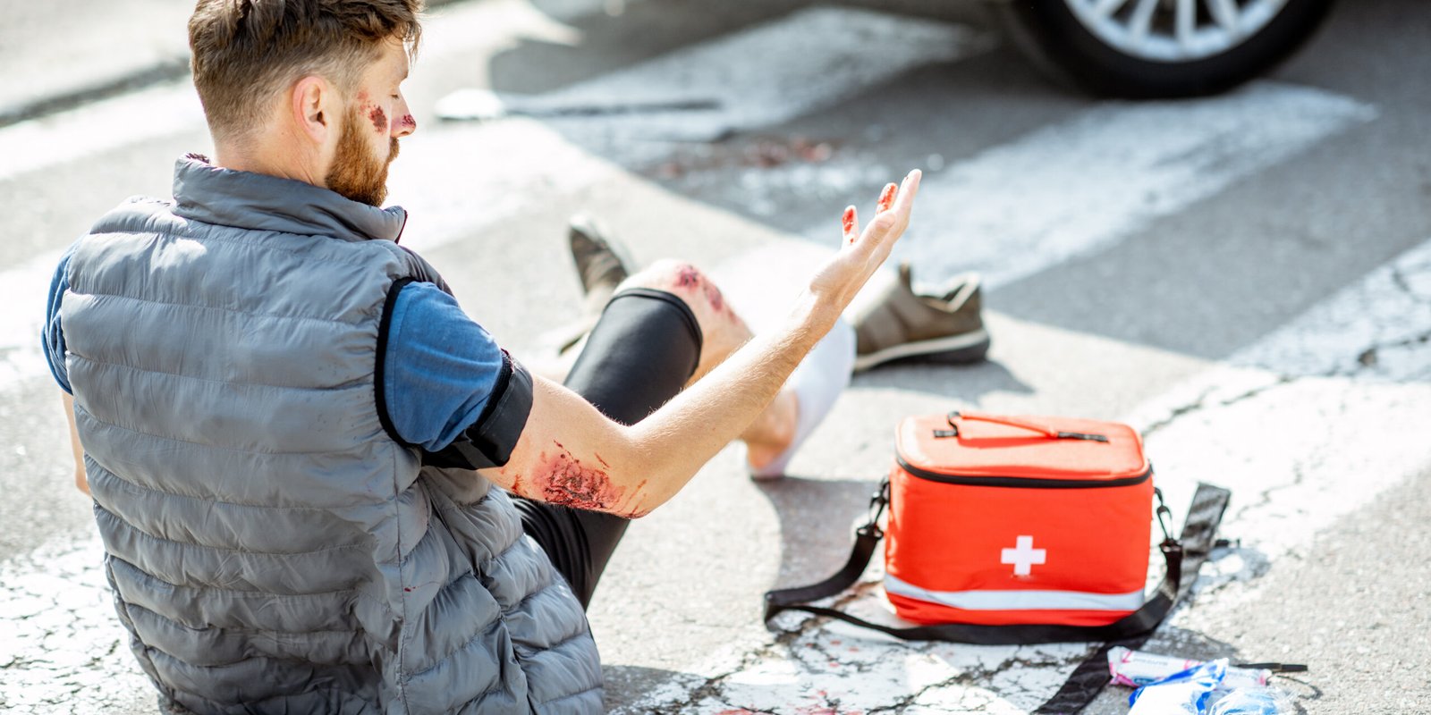 Injured man sitting on a crosswalk next to a car and a first aid kit, checking his bloody arm after a pedestrian accident.